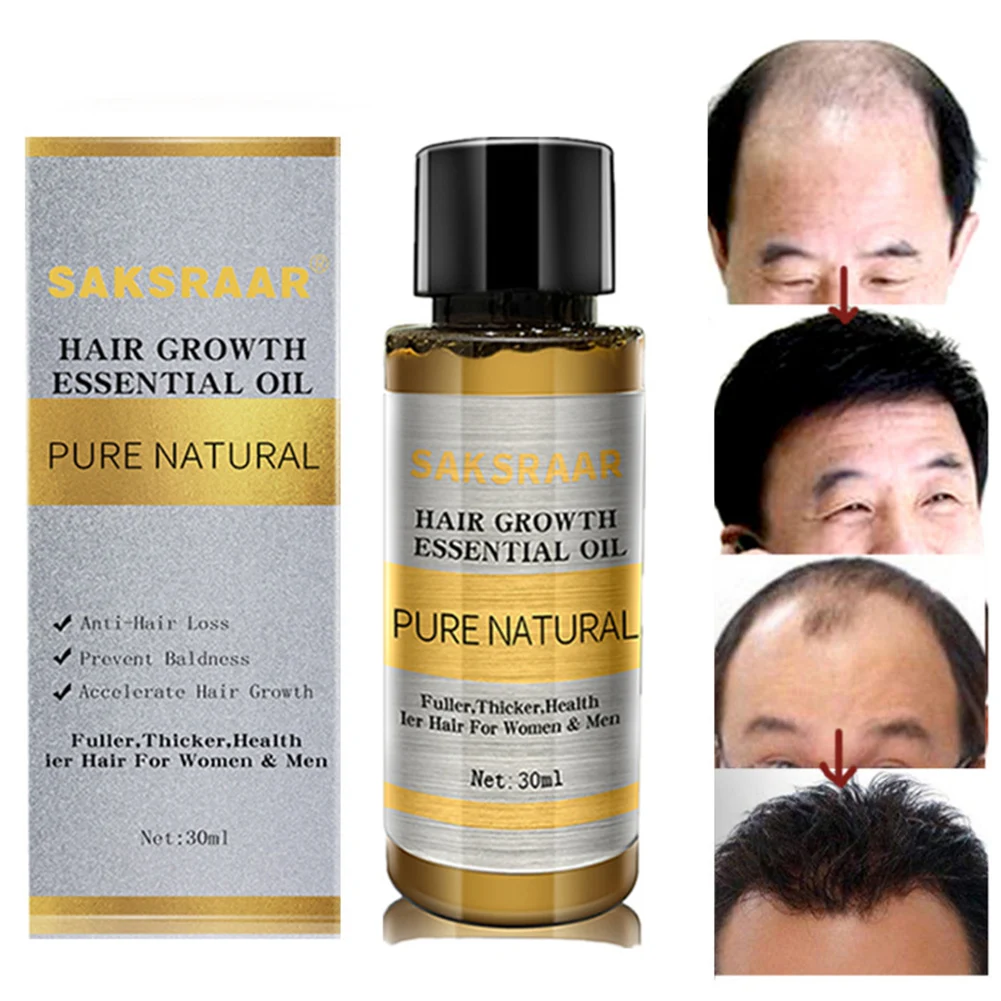 

30ML Hair Growth Essence Oil Prevent Hair Loss and Baldness Hair Care Essence Nourish Repair Damaged Hairs Serum for Man Woman