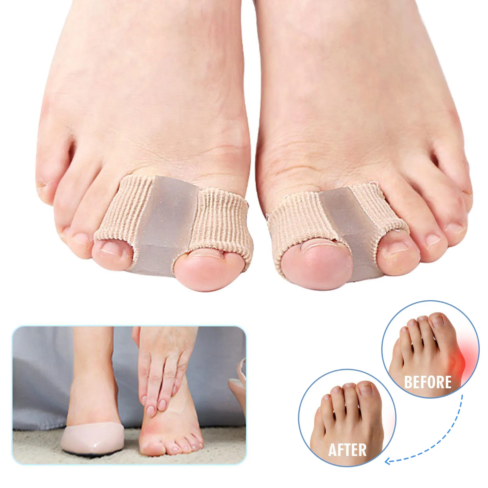 

2Pcs=1Pair Toe Spacer Separator Bunion Corrector Hallux Valgus Toenail Straightener Orthopedic Braces Thumb Correction Foot Care