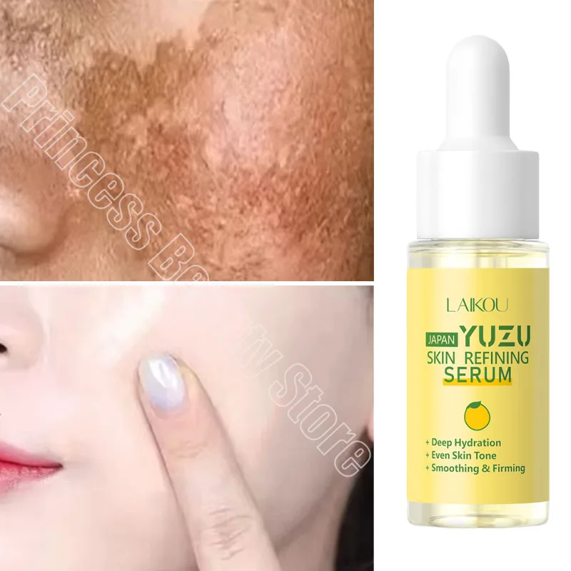 Отбеливающая Сыворотка для лица Dark средство удаления пятен коррекция веснушек