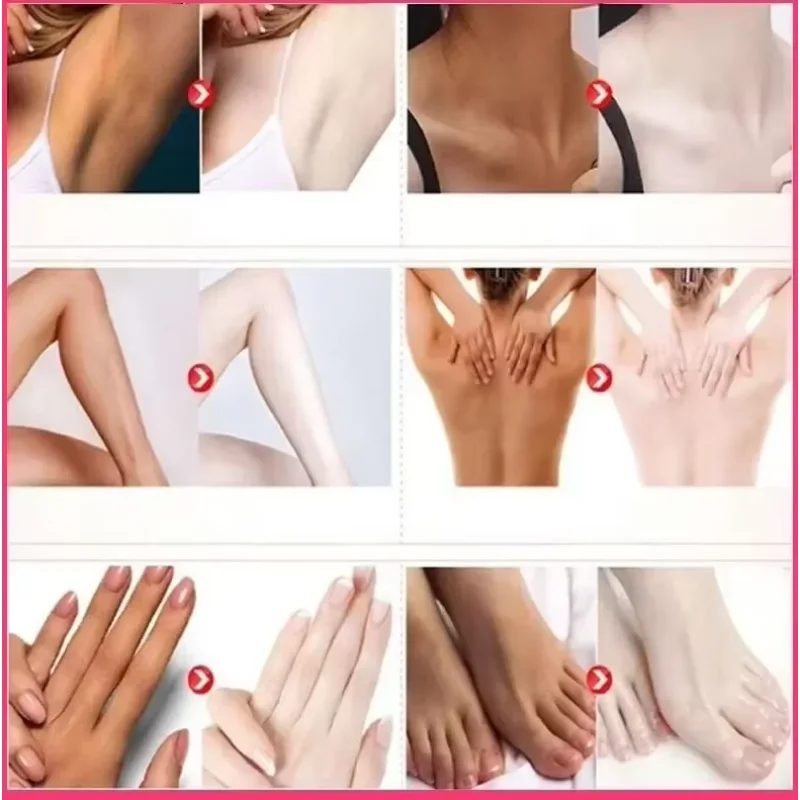 Отбеливающий крем для кожи осветления темной отбеливающий интимных частей рук