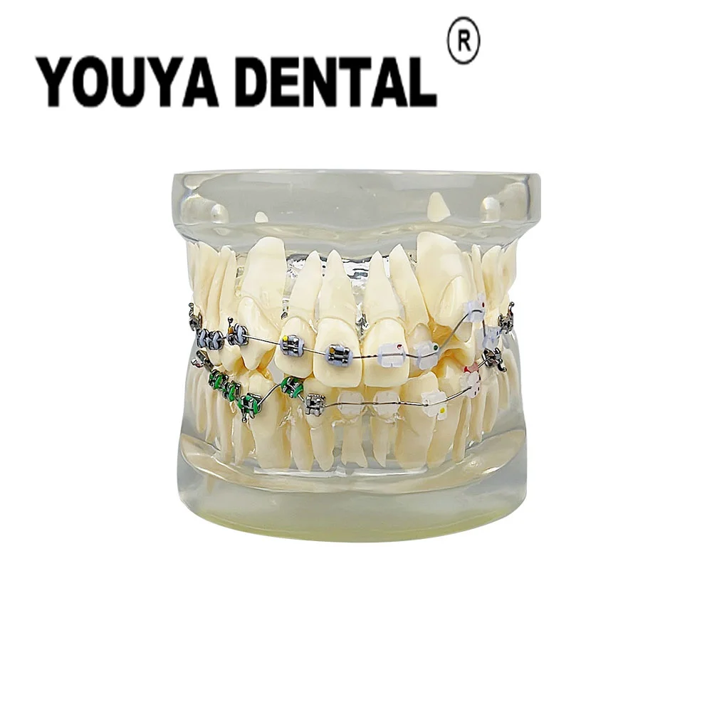 

Teeth Wrong Jaw Half Metal Half Ceramic Orthodontic Model Dental Model For Dentist Student Studying Teaching Demonstration Tool