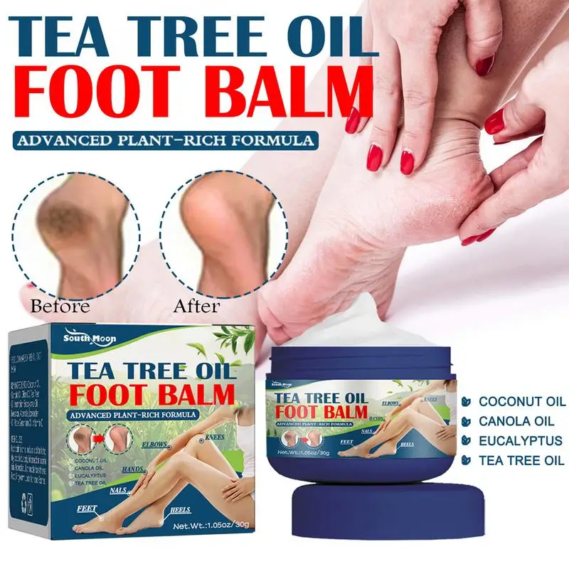

30g Foot Repair Cream Winter Moisturizing Nourishing Whitening Anticracking Foot Care Cream Suitable For Dead And Dry Skin