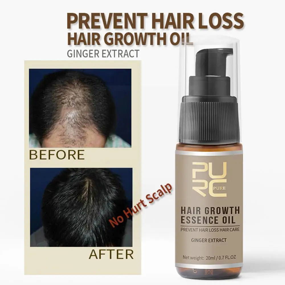 

Масло для роста волос PURC, продукты для быстрого роста волос, лечение кожи головы для мужчин и женщин, ts Предотвращение выпадения волос, истон...