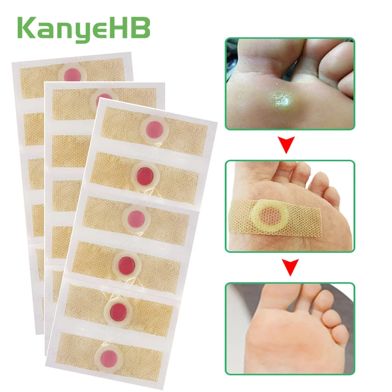 

18pcs Corn Patch Feet Calluses Remove Pain Relief Detox Herbal Medical Plaster Warts Curative Patches Corn Removal Stickers A173