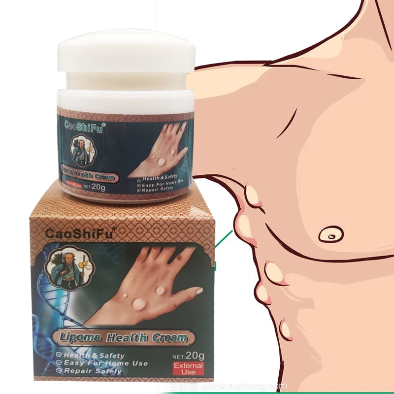 

Устройство для удаления опухолей, ZB, липома, 20 г, для быстрого удаления опухолей, обезболивания жира