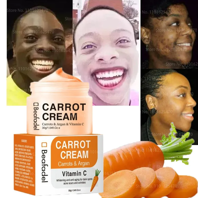 30ml cenoura vitamina c creme clareamento e clareamento de brilho inibindo melanina anti-envelhecimento acne-remoção de produtos de cuidados com a pele facial