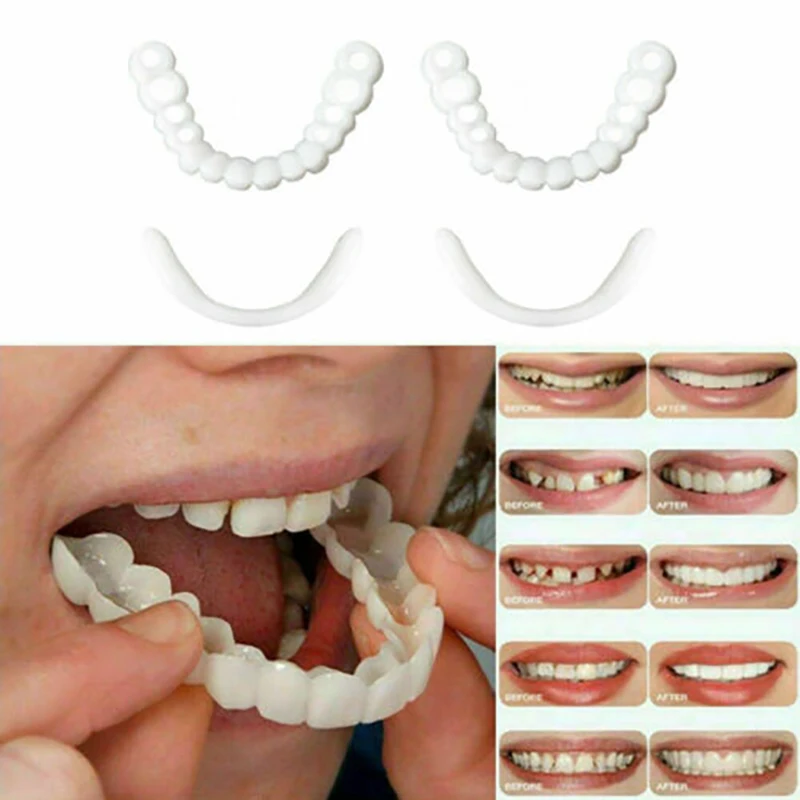 Как правильно одевать зубы. Snap on smile верхние и нижние. накладки на зубы съемные. виниры для зубов. накладки для зубов виниры.