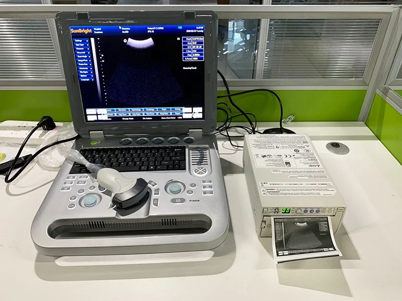 15 Inch LED Cardiac Ultrasound Echocardiography 3D 4D Laptop Ultrasound Machine