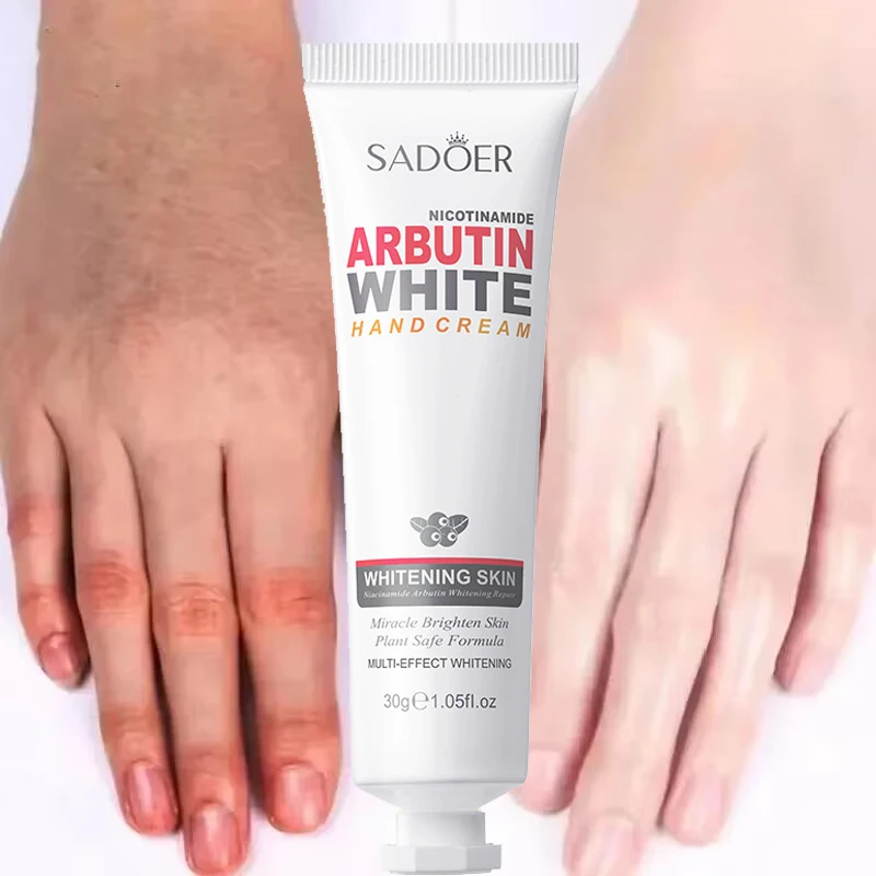 Никотинамидный отбеливающий крем для рук быстро выцветающий тусклый против