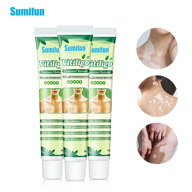 

1/2Pcs Vitiligo Treament Antibacterial Cream Mycosis Leukoplakia Plaster Psoriasis Localized Ointment White Spot Oil Skin Care