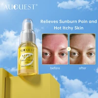 auquest after sun treatment oil hydrate and moisturize sunburn care relieve and calm skin body sunscreen whitening sun cream