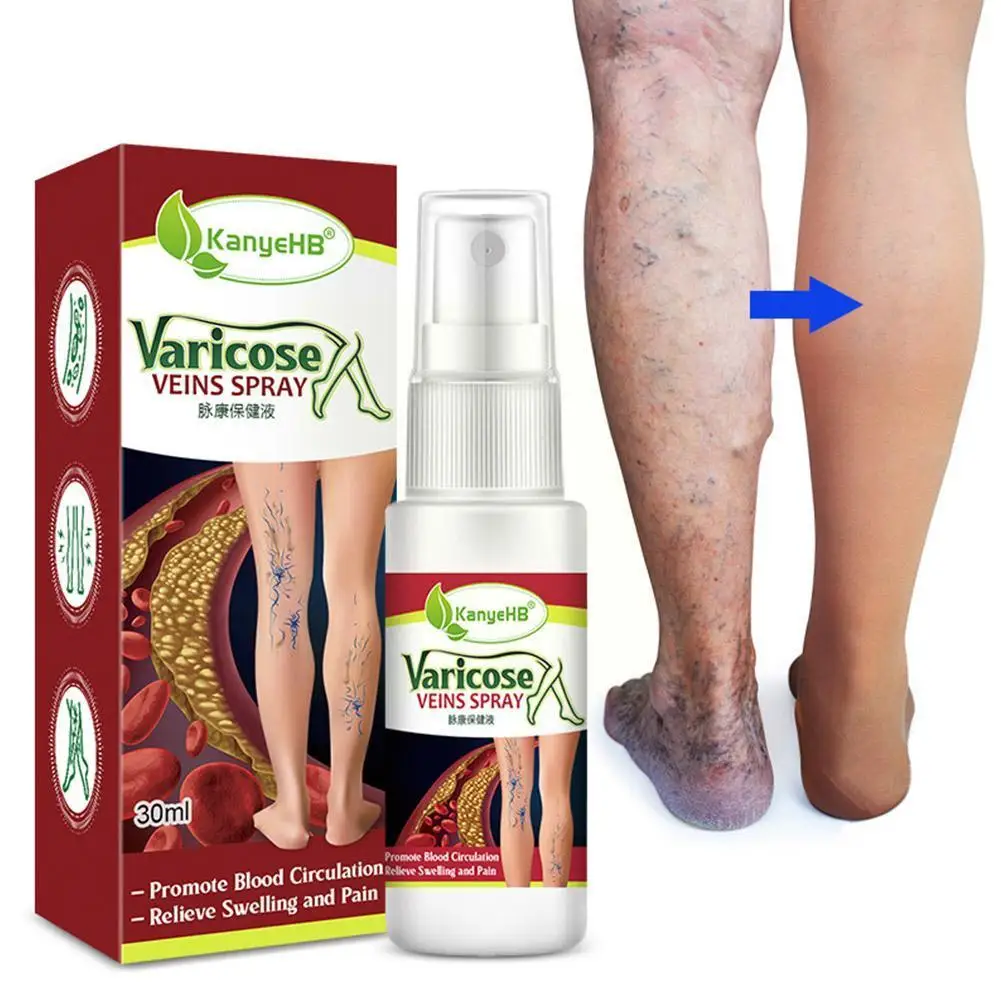 

Varicose Vein Spray Vasculitis Phlebitis Spider Legs Redness Blood Care Smoothing Pain Herbal Body Treatment Vessel Relief U4Z6