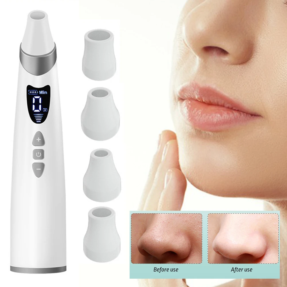 

Пылесос для удаления черных точек, профессиональный очиститель пор лица, товары для ухода за лицом