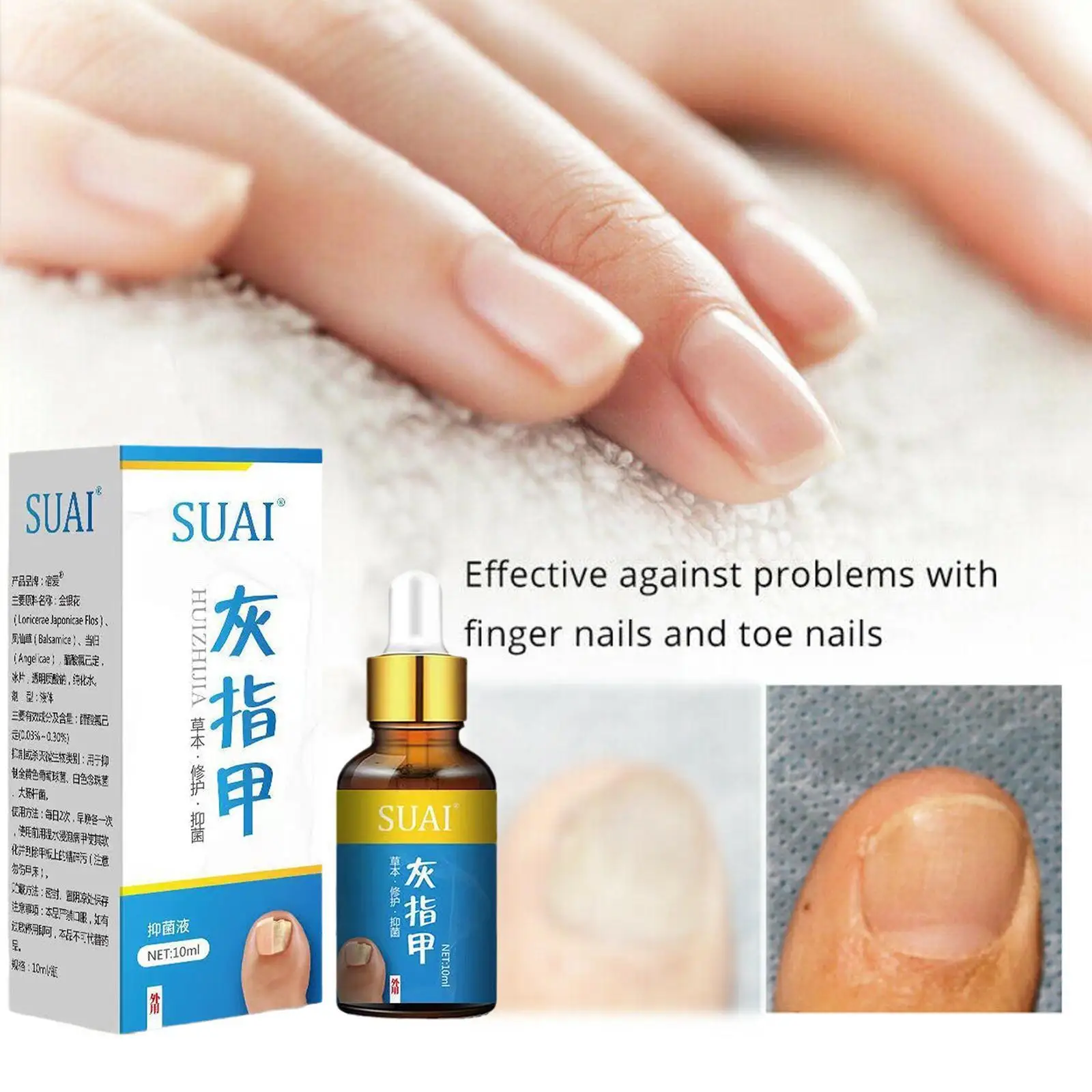 

Treatment Fungal Nail Repair Serum Onychomycosis Paronychia Foot Anti-fungal Nail Care Fungus Gel Products Removal Onychomy V4n0
