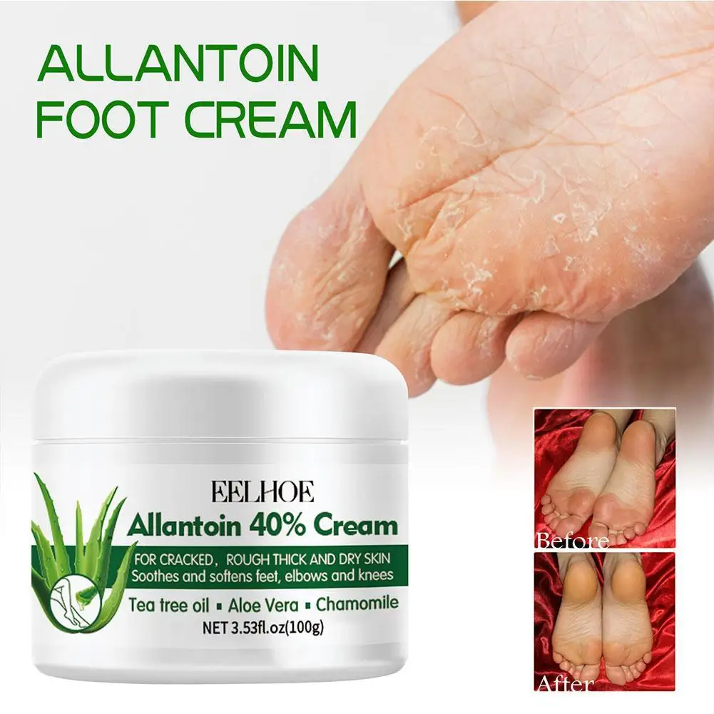 

Foot Cream Repair Dry Cracked Hands And Feet Smooth Fine Lines Moisturizing Hydrating Remove Callus Dead Skin Hand Foot Care