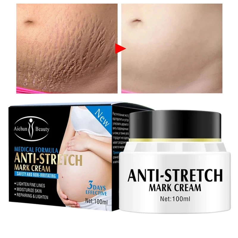

Stretch Marks Remover Treatment Cream Stretch Mark Removal Maternity Scar Slackline Repair Body Cream 100g