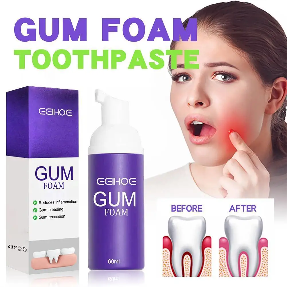 

Gum Foam Toothpaste Whitening Mousse V34 Bright White Breath Deep Refreshing Gums Ultra-fine Cleaning Teeth Stain Removal W8A2