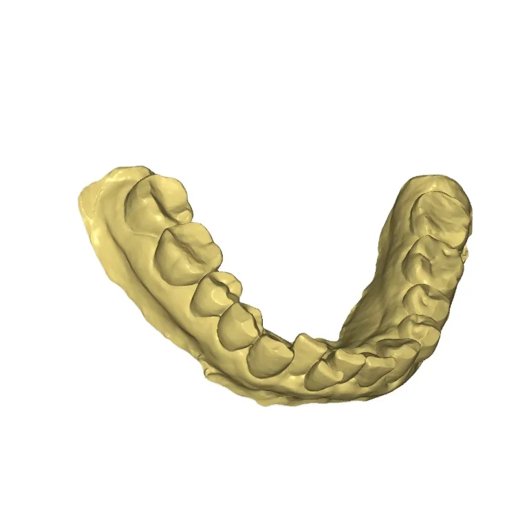 Самая маленькая цифровая система оттисков CAD CMD внутриротовой сканер с CE