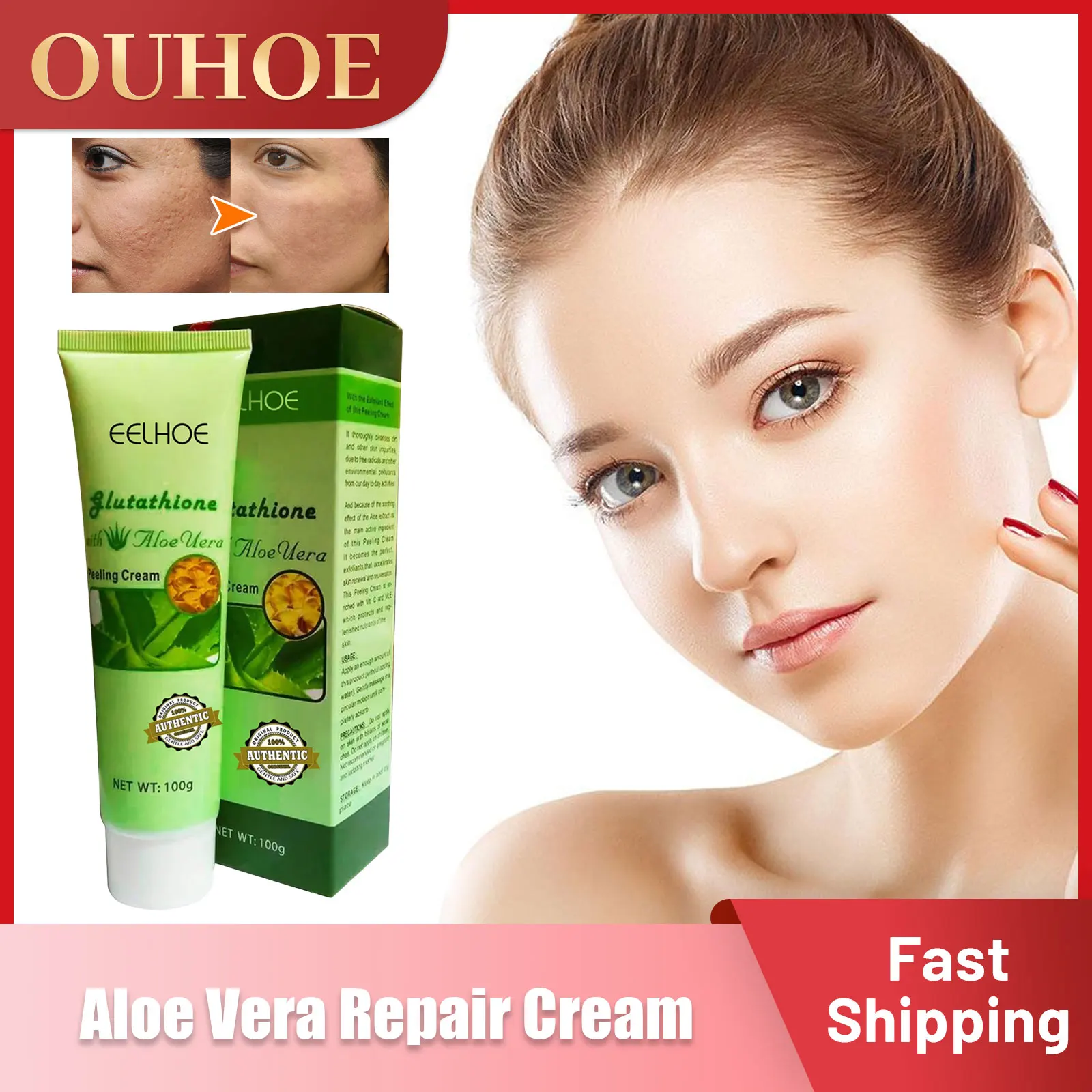 

Exfoliator Cream for Face Aloe Vera Moisturizing Fade Scars Freckles Acne Treatment Soothing Repair Skin Whitening Peeling 100g