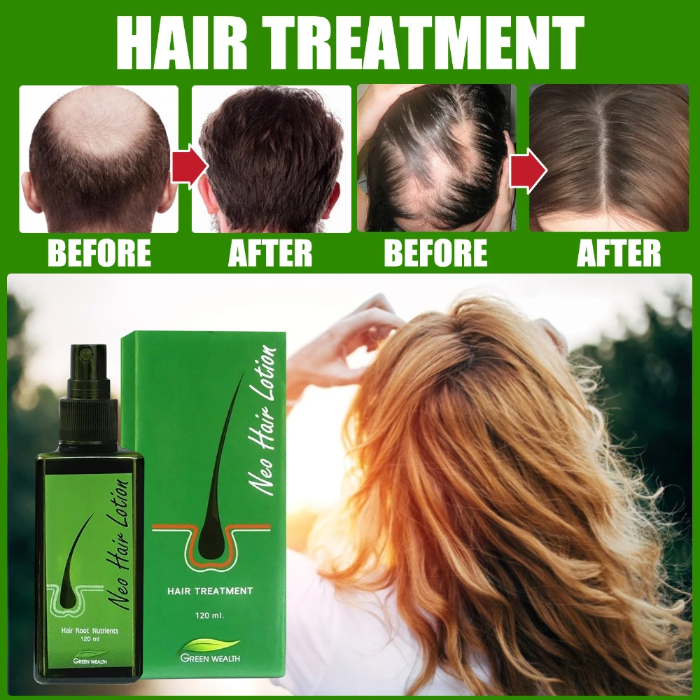 

120ml Neo Hair Lotion Original Hair Loss Serum Essence Oil Hair Growth Treatment Beauty Health Hair Care for Men Women