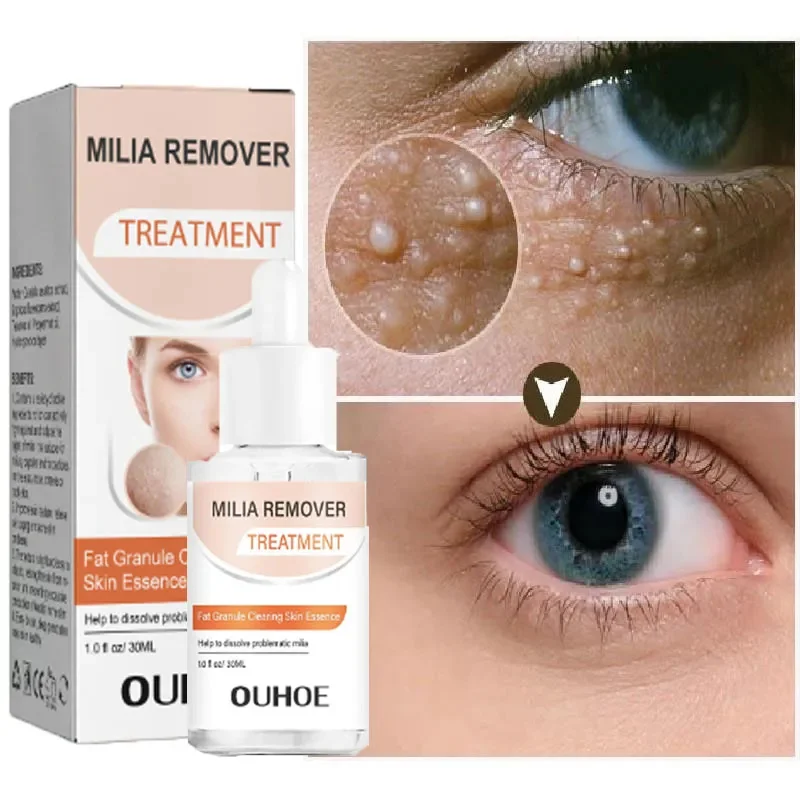 

Fat Granules Milia Removal Serum Fade Dark Circles Bags Puffiness Under Eyes Anti-Aging Moisturizing Firming Beauty Eye Care