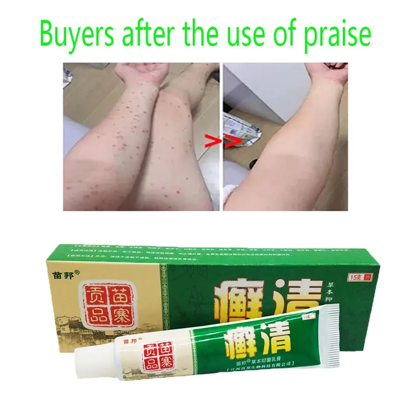 

China's Secret Recipe Herbal Extract Cowskin moss cream for dermatitis and eczema Skin Dermatitis Ointment