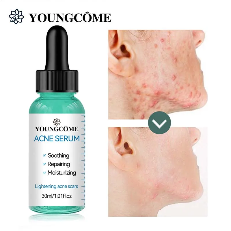 

Сыворотка увлажняющая и восстанавливающая для лица, с экстрактом