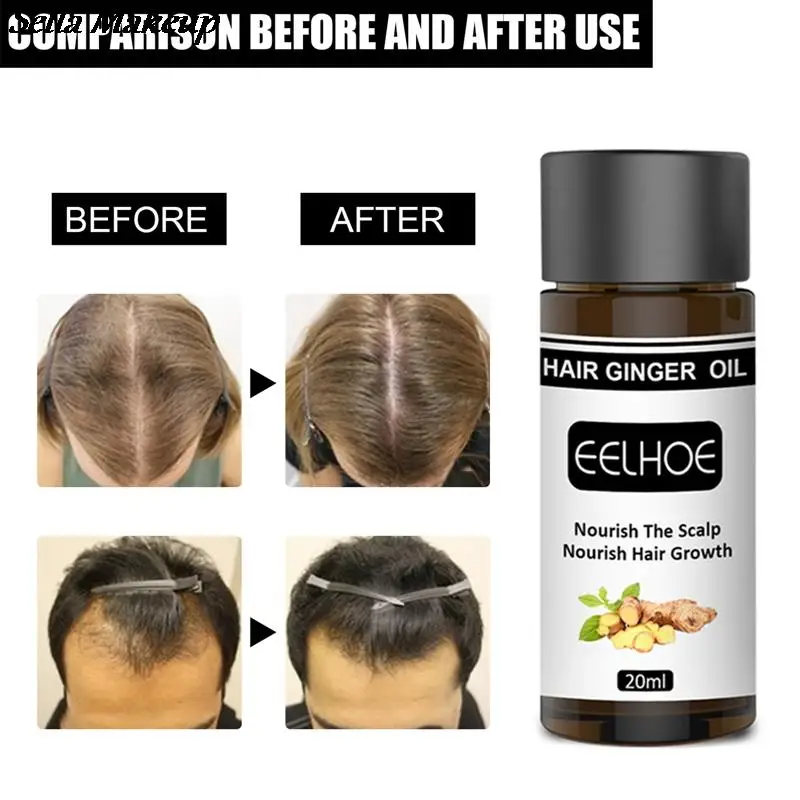 

20ml Ginger Hair Growth Essential Oil Serum Anti Hair Loss Beauty Products Fast Grow Treatment Dry Frizzy Damaged Hair Care