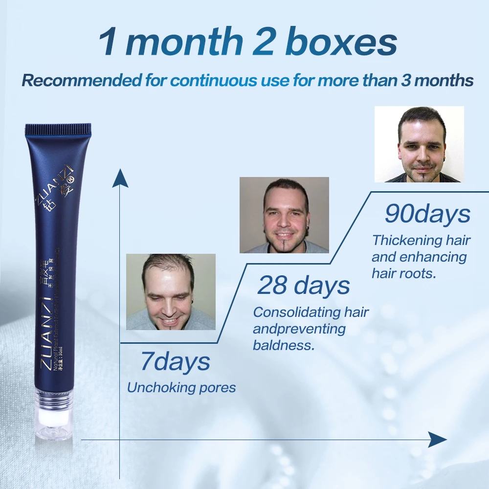 Тройной роликовый массажер для лечения выпадения волос способствует