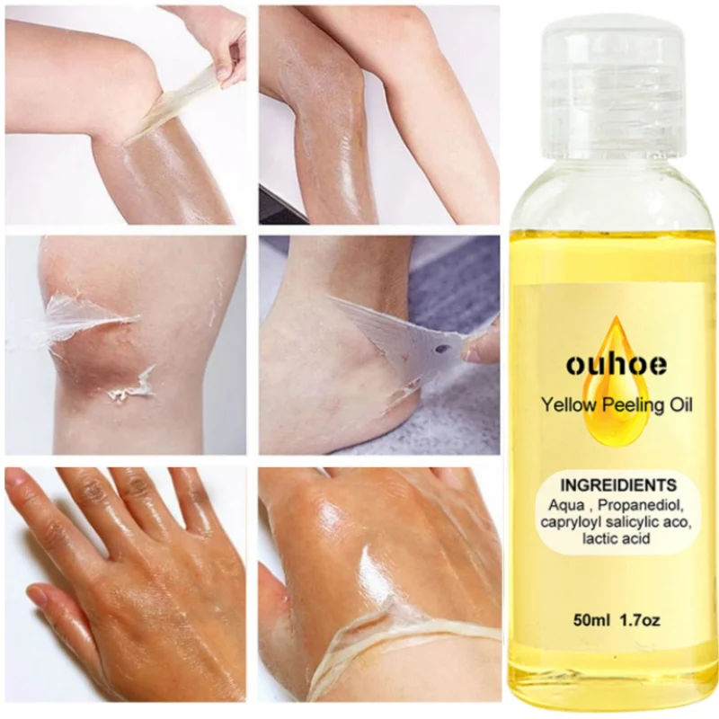 

Yellow Peeling Oil Dark Skin Bleaching Remove Arm Knee Legs Melanin Body Lightening Scrub Exfoliating Dead Skin Whitening Serum