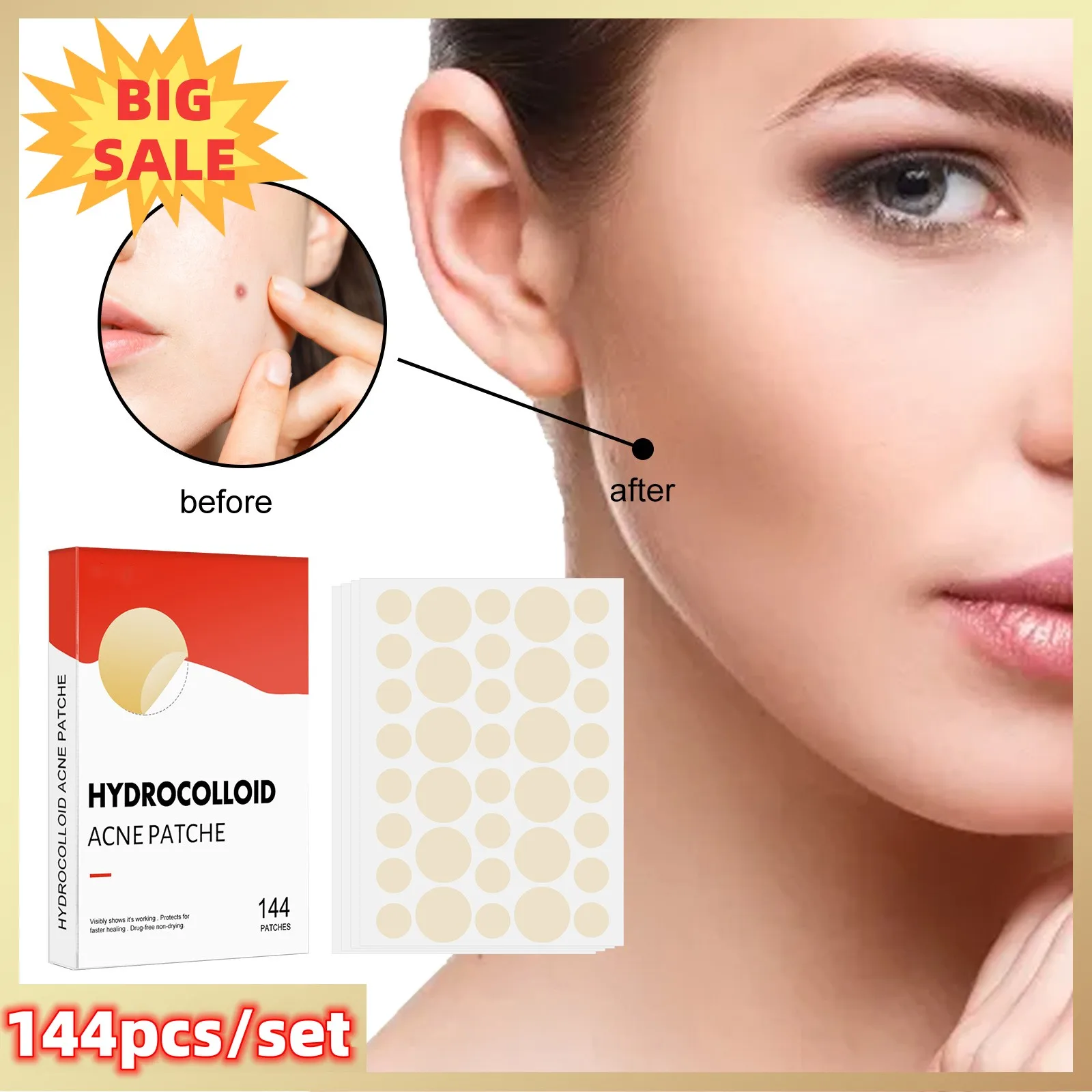 

144pcs/set Face Men Women Skin Care Acne Pimple Patch 2 Sizes Invisible Professional Healing Absorbing Spot Sticker Covering