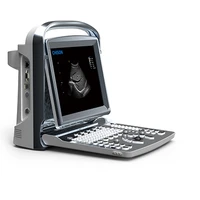 chison eco1 portable ultrasound scanner medical ultra sound machine medical ultrasound instruments