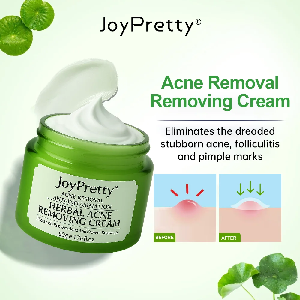 JoyPretty Herbal Acne Treatment Face Cream Elimina