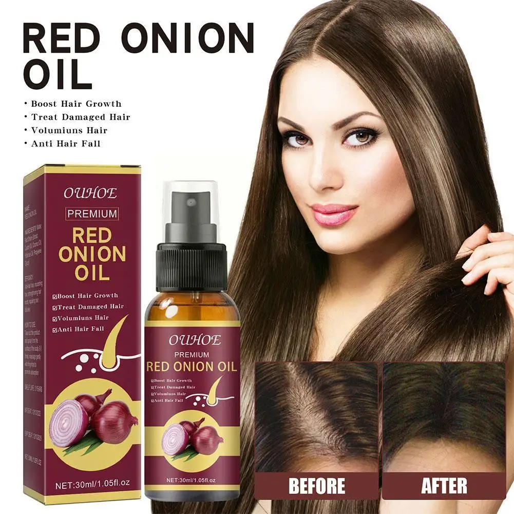 

30ml Onion Black Seed Hair Oil Spray, Natural Hair Prevent Care Biotin Hair And Growth Loss, Fast Hair S2P7