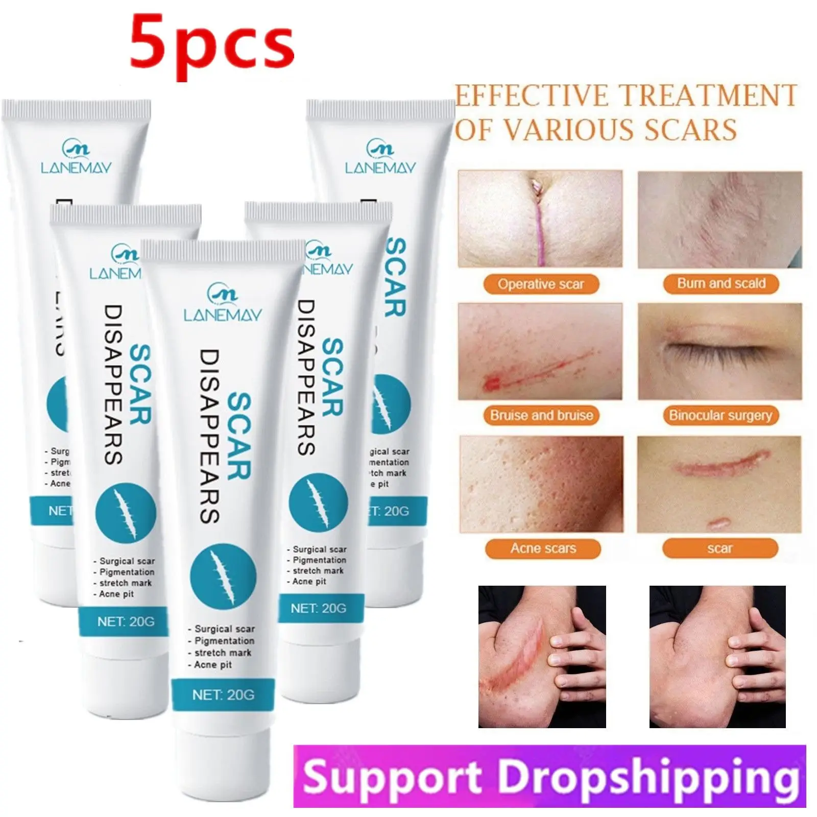 

5Pcs Scar Removal Cream Repair Stretch Marks Burn Acne Surgical Acne Scar Ointment Herbal Treatment Gel Whitening Health Care