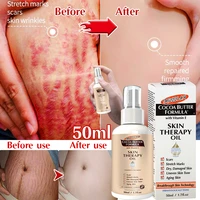 stretch mark spray repair removal acne scar stretch marks cream fat scar striae gravidarum treatment streaks obesity