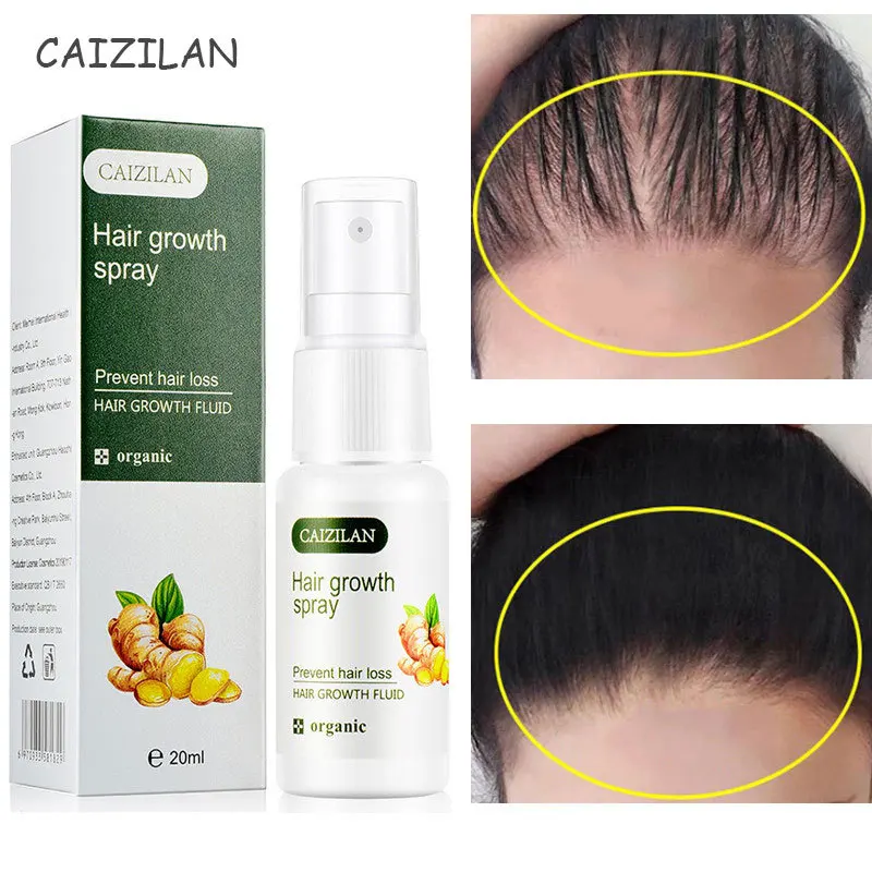 

Ginger Hair Growth Spray Natural Anti Hair Loss Products Fast Growing Prevent Baldness Thinning Treatment Repair Germinal Liquid