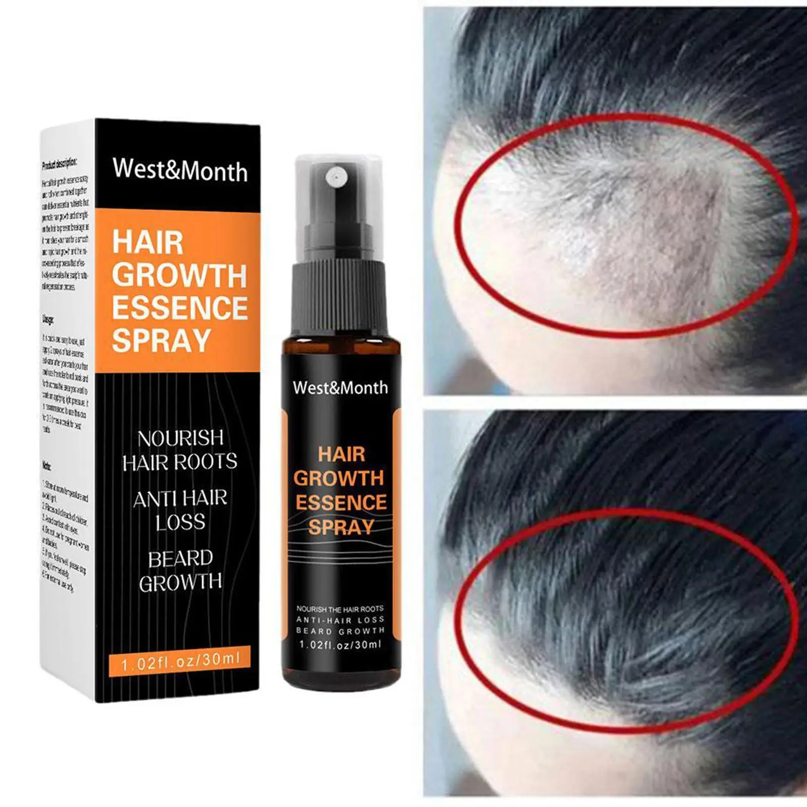 

Спрей Heshouwu для роста волос, эфирное масло для лечения сухих поврежденных волос, восстанавливающий спрей для предотвращения пудры, уход за волосами Y7O1