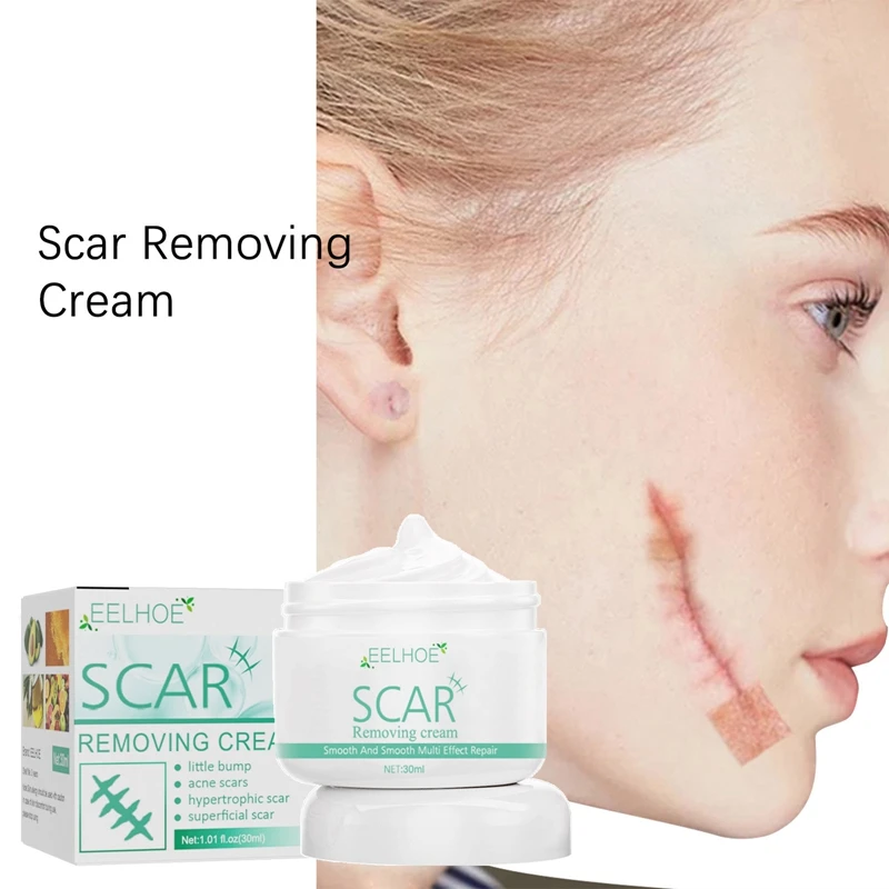 

30ml Removal Scar Cream Acne Treatment Whitening Moisturizing Cream Face Pimples Scar Stretch Marks Removal Paste Unisex