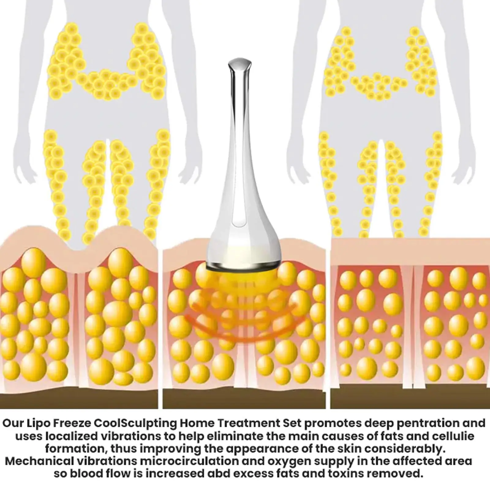 Антифриз 70 г мембрана для замораживания жира аппарат похудения Липо