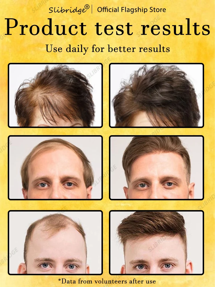 98% покупателей покупают снова у них все больше волос попрощайтесь с облысением