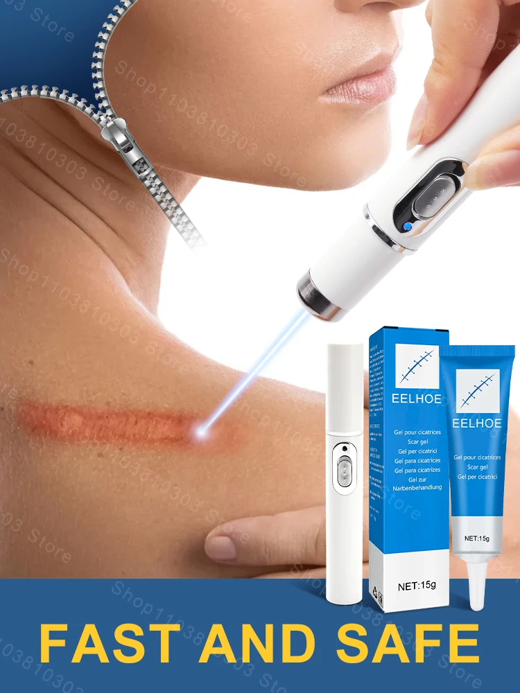 Лазерная терапия шрам Keloid улучшение шрамов ручка для облегчения легкая