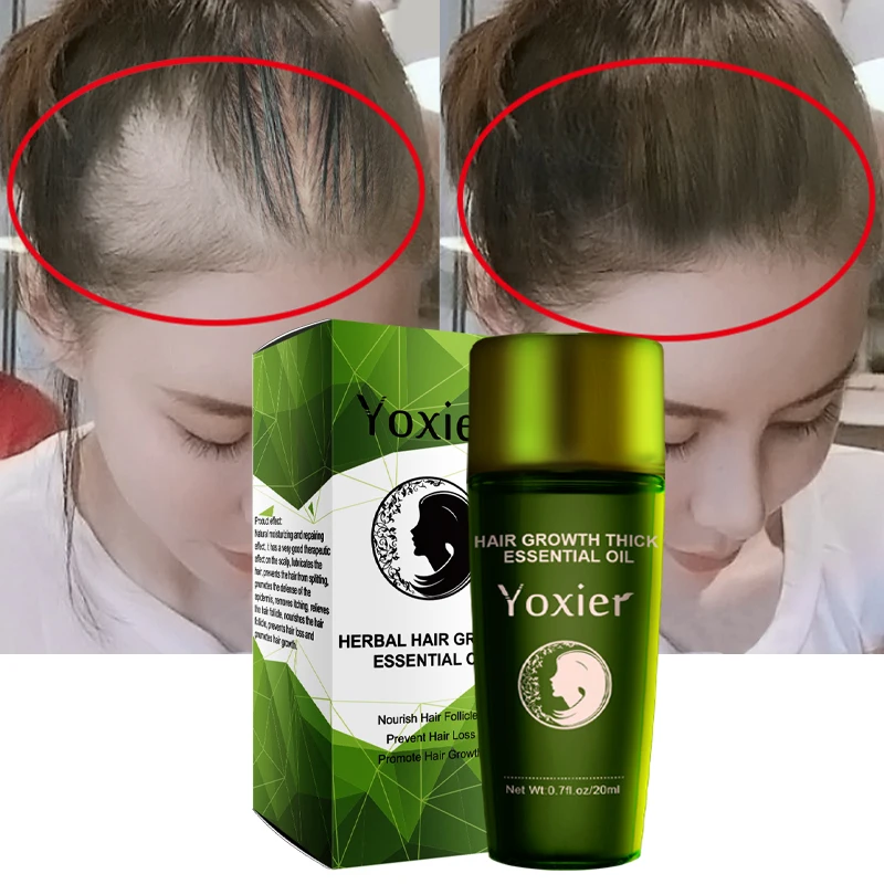 Эффективное средство для быстрого роста кожи головы увлажняющее против