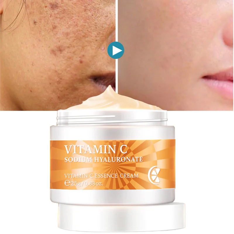 

Vitamin C Whitening Freckle Cream Instant Remove Face Melasma Dark Spot Melanin Anti-Aging Moisturizer Brighten Skin Care