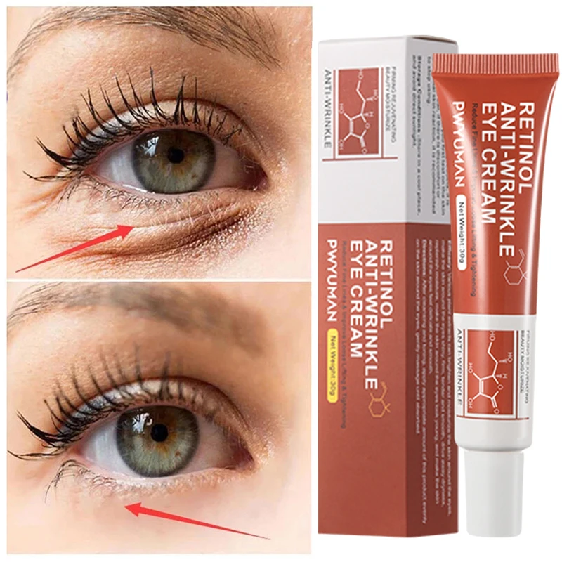 

Retionl Anti-Wrinkle Eye Cream Fades Dark Circles Remove Eye Bags Anti Puffiness Gel Whitening Moisturizing Eye Beauty Skin Care