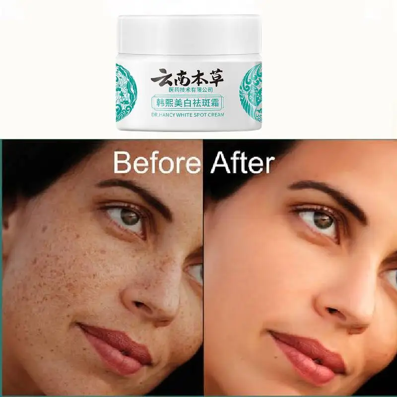 

Yunnan Materia Medica Han Xi Whitening And Spot Removing Cream Freckles Brightening Skin Color Moisturizing Spot Removing Cream