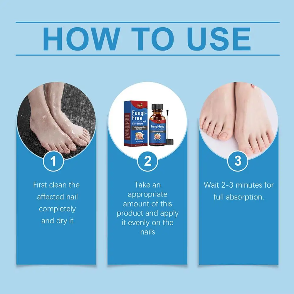 ł na grzybicę paznokci Serum do usuwania grzybów Przeciw infekcjom Paronychia Onychomycosis Paznokcie stóp Produkty pielęgnacji 30 мл