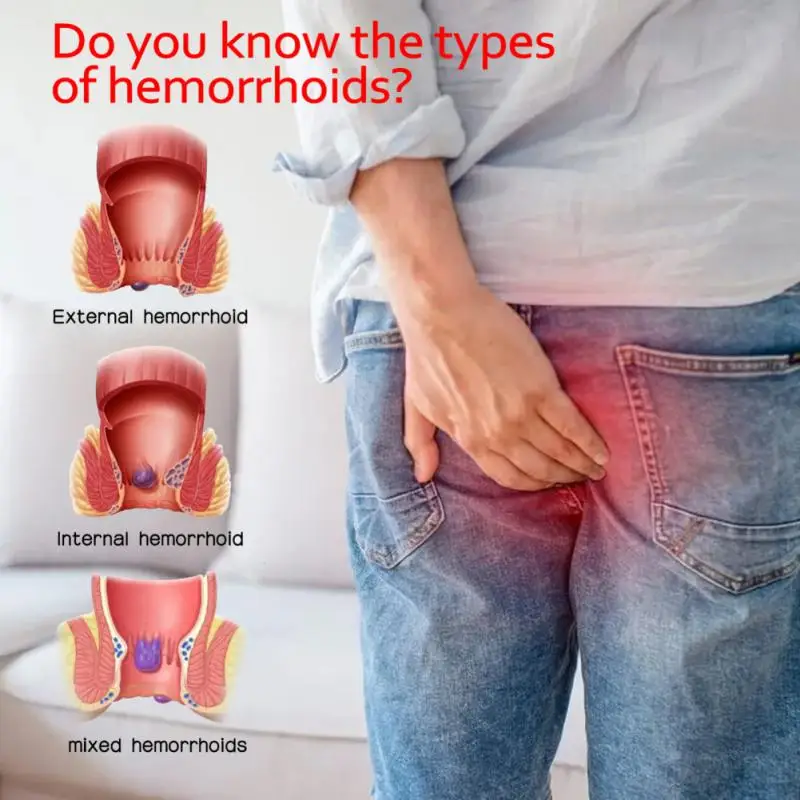 

Крем от геморроя китайский, 30 г