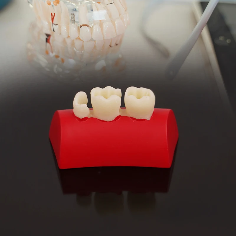 Модель ротового наполнения стоматологическая инкрустация модель для упражнений