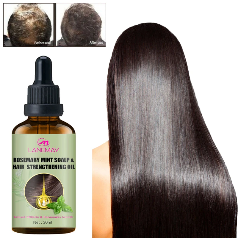 

Herbal Hair Growth Essential Oil Anti Hair Loss Treatment Fast Growing Thicker Prevent Baldness Thinning Damaged Hair Care 30ml